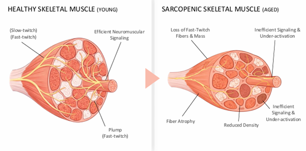 Lifton Dermatology Introduces TriLift ㅣ From Facial Muscles to Body Firmness image 2