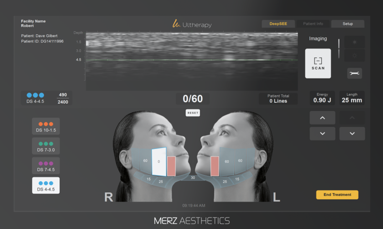For Ultherapy Prime, precision targeting matters more than the number of shots. image 4