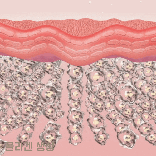 울쎄라 정품인증 확인 꼭 받아야 하는 이유 관련 이미지 3