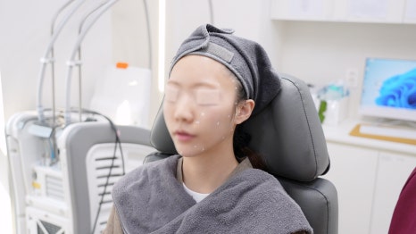 스타일에이지 필러, 윤곽고정으로 자연스럽게 설계하는 이유 관련 이미지 14