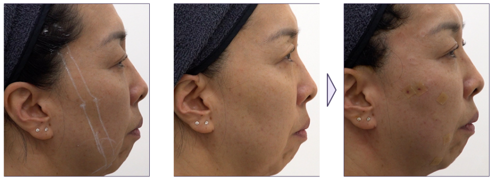 Reifton Dermatology Participates in a Sinclair Roundtable Academic Presentation image 7