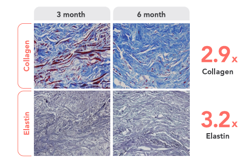 Rejuran vs. Lituo: What’s the Difference, and Which Procedure Is Right for My Skin? image 7