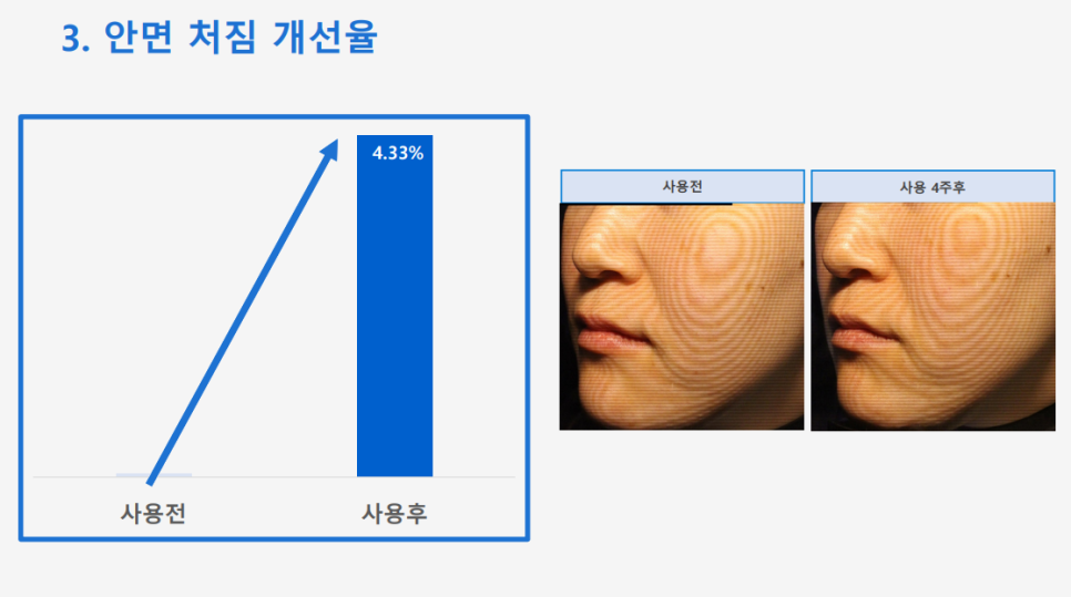 Anti-Aging Cosmetic with Dermatologist Expertise: 'Lifton Wrinkle Shot' Needle Patch Launched image 7