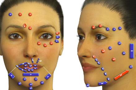 What Is MD Codes Filler? Why It Looks Naturally More Youthful image 1