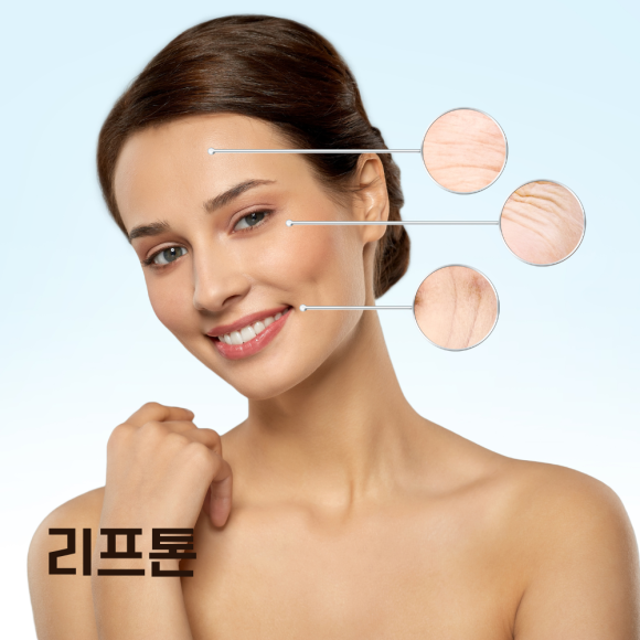How to Get the Full Effect of Ulthera image 2