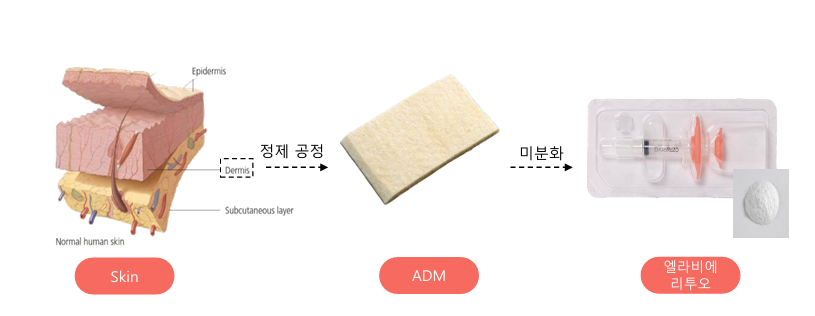 신사 엘라비에리투오 피부 겉이 아닌 속부터 개선하는 스킨부스터 관련 이미지 6