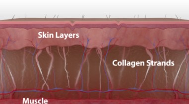 If You Didn’t See Results After Thermage, Be Sure to Read This (Must-Read for Those Who Feel Thermage Doesn’t Work) / Gangnam Sinsa Station Dermatology Clinic image 2