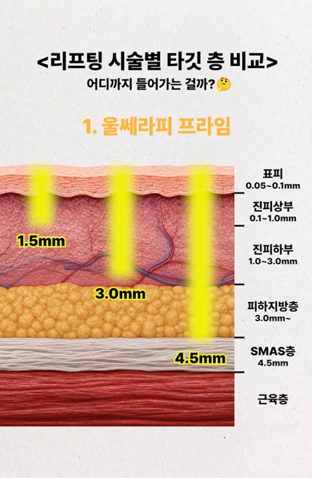 울써마지, 같이 하면 얼굴에 너무 강하지 않을까? 관련 이미지 3