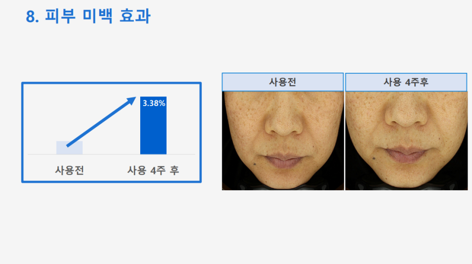 Anti-Aging Cosmetic with Dermatologist Expertise: 'Lifton Wrinkle Shot' Needle Patch Launched image 12