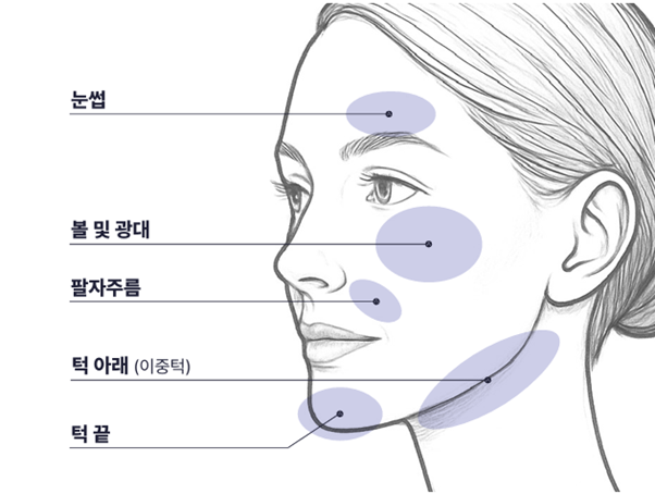 압토스 핸즈온 세미나로 다시 확인한 실리프팅 설계의 중요성 관련 이미지 9