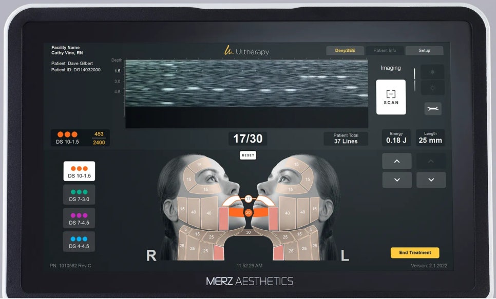 LeapTone Dermatology Clinic, First in Korea to Adopt the Upgraded Ultherapy PRIME image 3