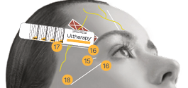 Ultherapy Prime: Facial Sagging Appears Differently Depending on the Area image 8