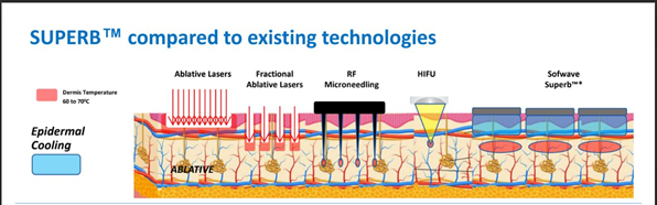 At What Stage Is Shinsa Sofwave Considered? image 5