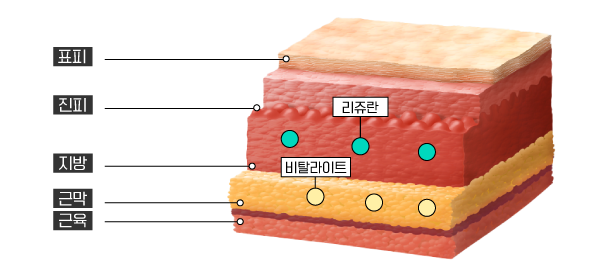 레스틸렌 비탈라이트, 마스터 닥터의 경험이 관련 이미지 3