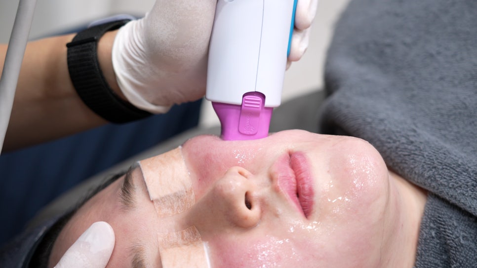 Sinsa Thermage FLX | LiftTone Dermatology Conducts Hands-on Training image 8