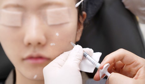 스타일에이지 필러, 윤곽고정으로 자연스럽게 설계하는 이유 관련 이미지 15