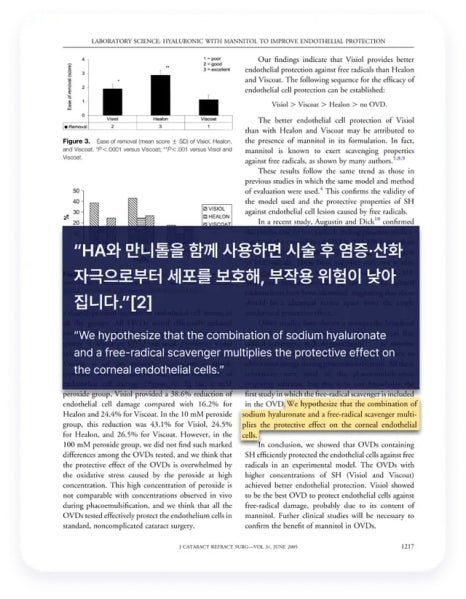 스타일에이지 필러, 윤곽고정으로 자연스럽게 설계하는 이유 관련 이미지 12