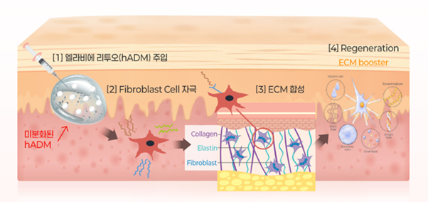 리프톤 피부과 리투오 Expert Clinic 선정, 결과가 달라지는 이유 관련 이미지 3