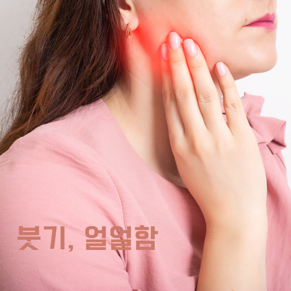 울쎄라 음주 권하지 않는 이유 관련 이미지 4