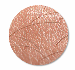 Restylane Vital Light Explained by a Dermatology Specialist image 5