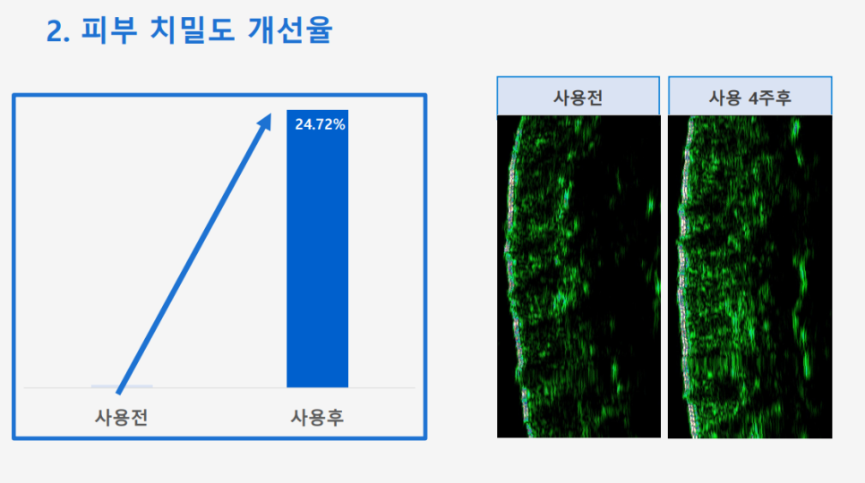 Anti-Aging Cosmetic with Dermatologist Expertise: 'Lifton Wrinkle Shot' Needle Patch Launched image 6