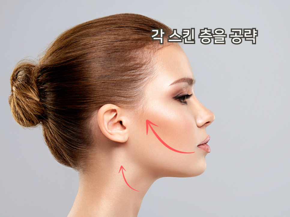 써마지 울쎄라 같이 해도 되나요 관련 이미지 4