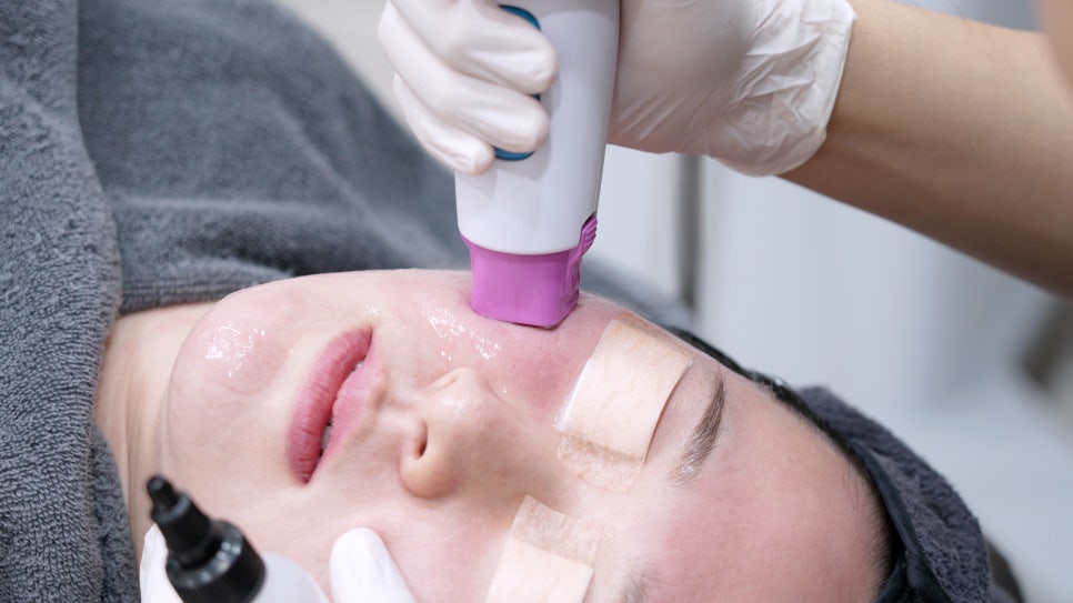 Sinsa Thermage FLX | LiftTone Dermatology Conducts Hands-on Training image 2