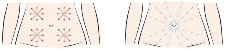 레디어스&hellip;새로운? 볼륨부스터/스킨부스터로서의 효과 관련 이미지 9