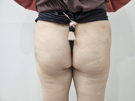 LIFTON Dermatology Participates in the 2025 Spring Academic Conference image 5