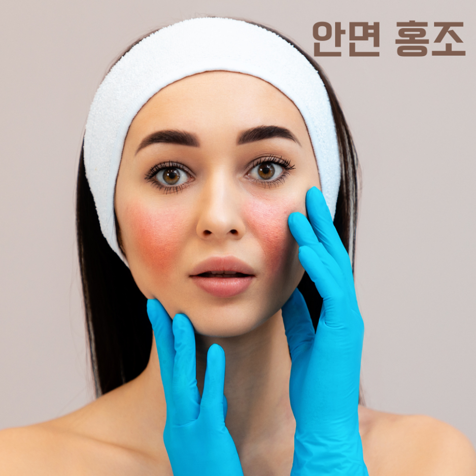 울쎄라 음주 권하지 않는 이유 관련 이미지 3
