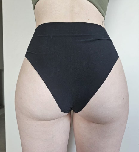 2025 KAAD 하계 학술대회 강연 후기｜Buttock 시술의 미용적 접근과 임상적 고찰 관련 이미지 4