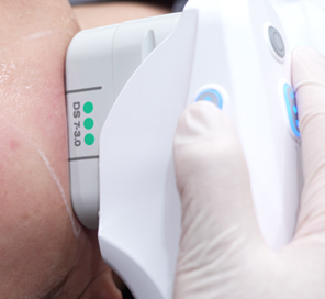 Ultherapy Prime: Facial Sagging Appears Differently Depending on the Area image 5