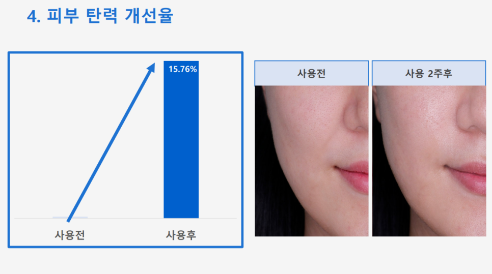 Anti-Aging Cosmetic with Dermatologist Expertise: 'Lifton Wrinkle Shot' Needle Patch Launched image 8