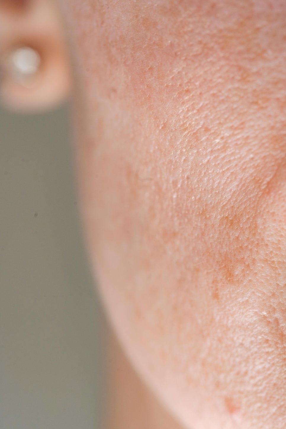 How to Reduce Pores image 2