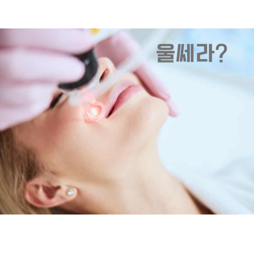 팔자주름 울쎄라 대표원장이 직접 알려드립니다 관련 이미지 3