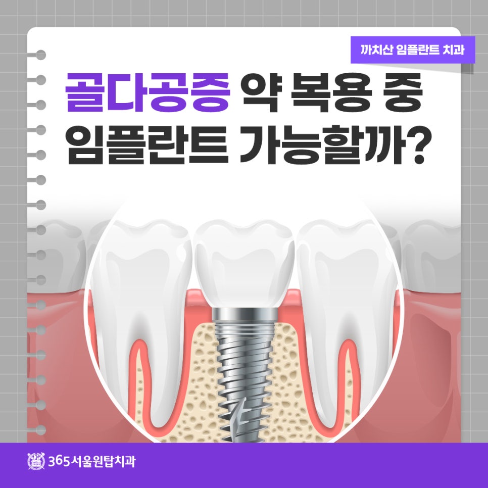 까치산임플란트 치과, 골다공증 약 복용 중 임플란트 가능할까? 관련 이미지 10