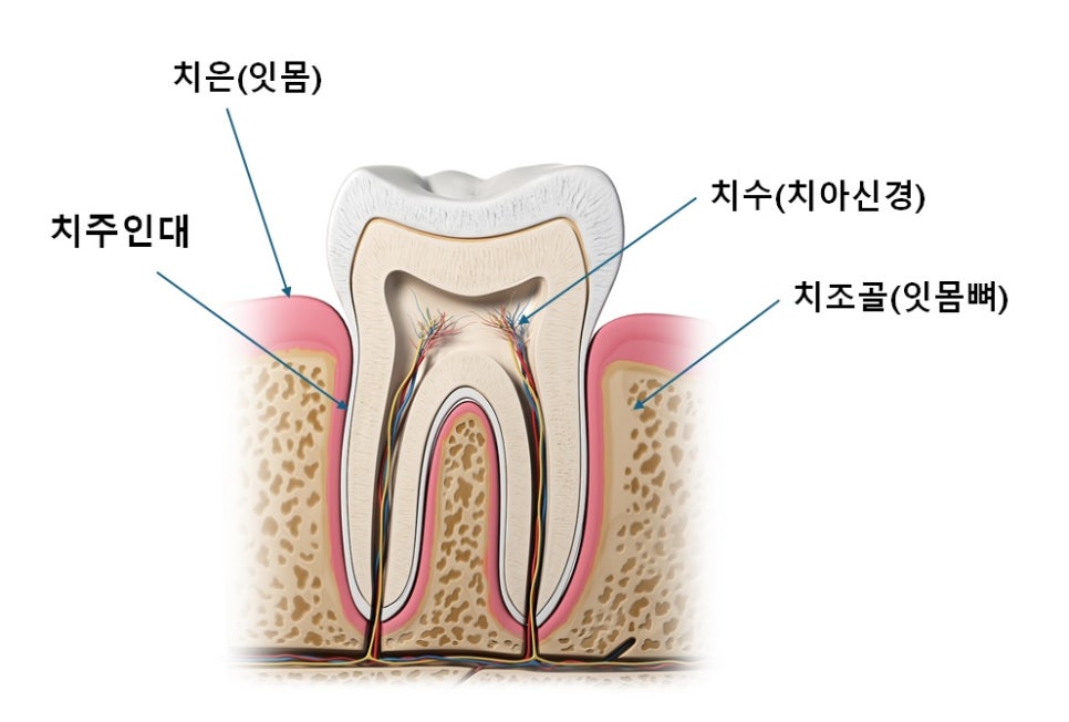 염창동치과 임플란트 주위염과 치주인대, 자연치아와 다른 이유 관련 이미지 2