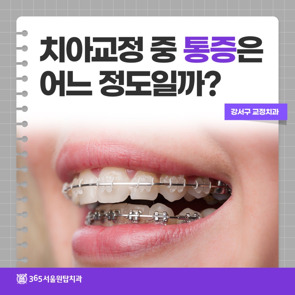 강서구교정치과, 치아교정 중 통증은 어느 정도일까? 관련 이미지 12