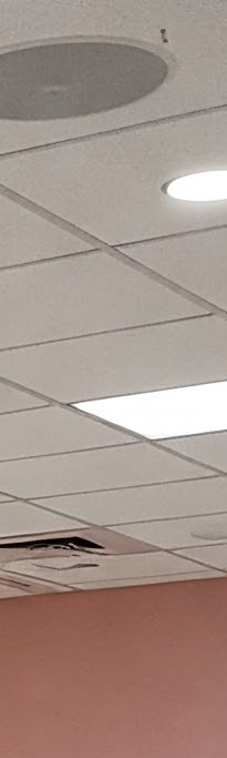 화곡역치과 치아가 빠진 개수만큼 임플란트를 심어야 될까? 관련 이미지 23