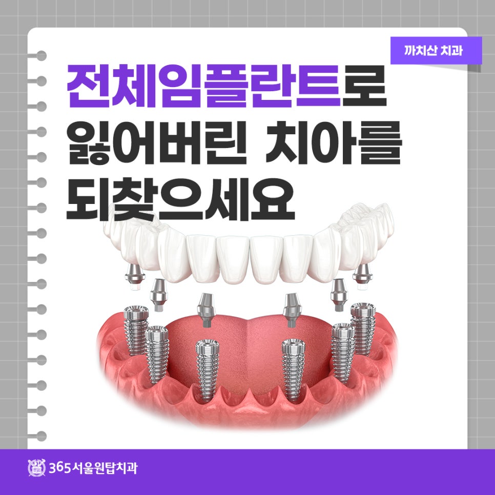 까치산치과, 전체임플란트로 잃어버린 치아를 되찾으세요. 관련 이미지 14