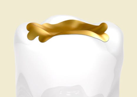 Yangcheon-gu Dental Clinic: 3 Problems That Can Occur If You Miss the Time to Replace Dental Prostheses image 3
