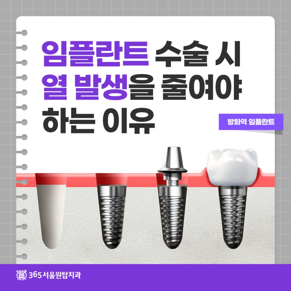 방화역치과, 임플란트 수술 시 열발생을 줄여야 하는 이유 관련 이미지 6