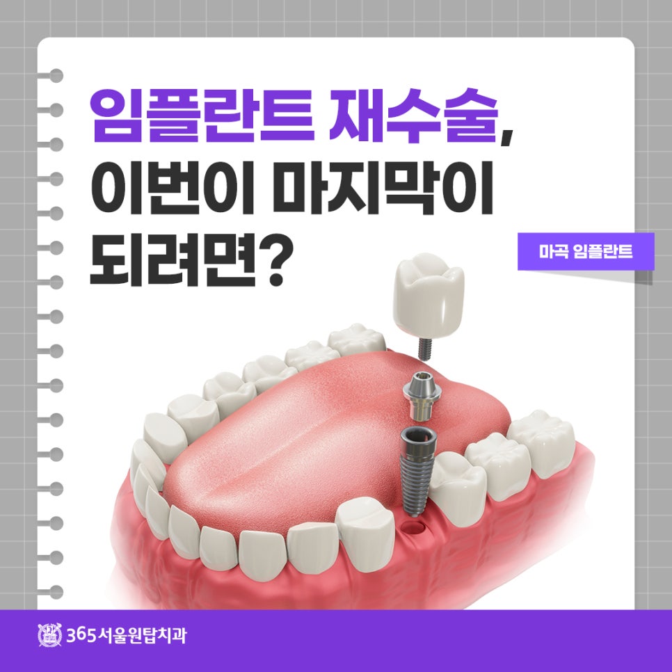 마곡임플란트 재수술, 이번이 마지막이 되려면? 관련 이미지 9