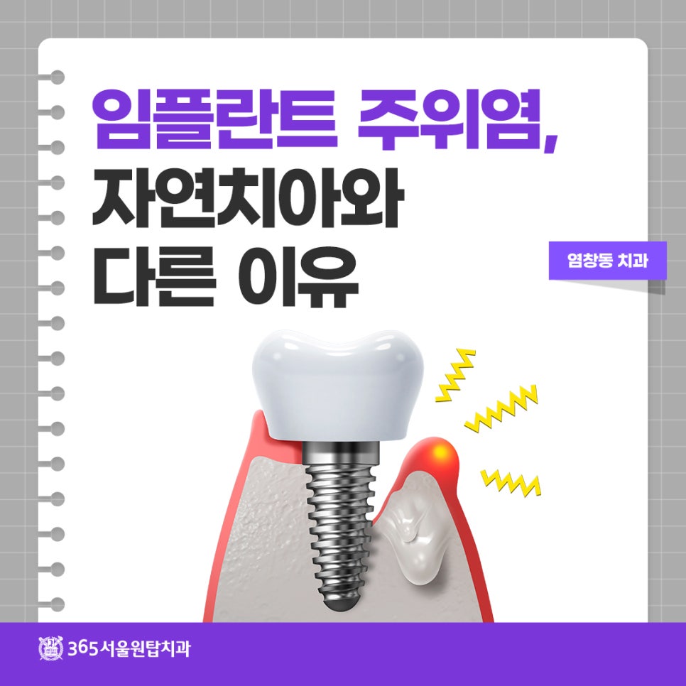 염창동치과 임플란트 주위염과 치주인대, 자연치아와 다른 이유 관련 이미지 10