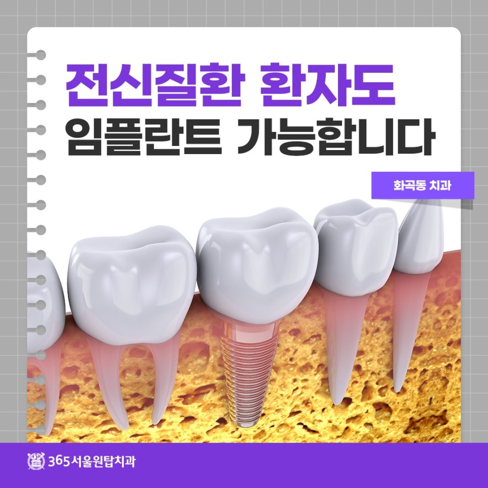 화곡동치과, 전신질환 환자도 임플란트 가능합니다 관련 이미지 5