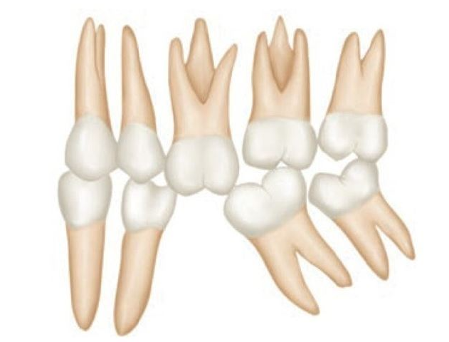 신월동치과 임플란트 심는 자리만 보면 안 되는 이유 관련 이미지 5