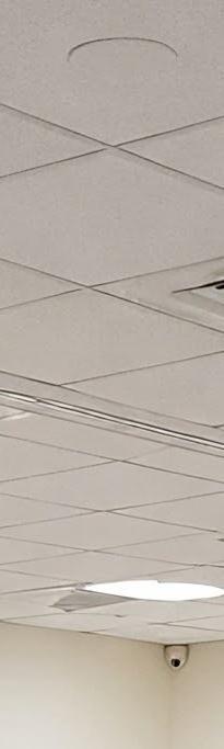 화곡역치과 치아가 빠진 개수만큼 임플란트를 심어야 될까? 관련 이미지 20