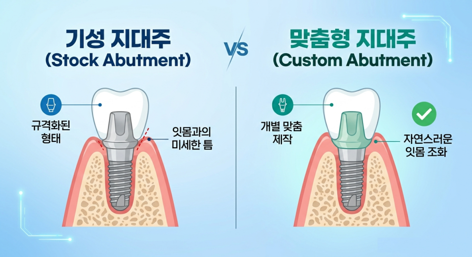 화곡동치과 2030 임플란트, 가격보다 중요한 체크리스트! 관련 이미지 3
