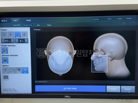 마곡임플란트 재수술, 이번이 마지막이 되려면? 관련 이미지 4