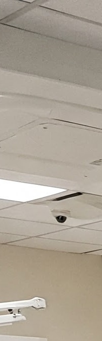 화곡역치과 치아가 빠진 개수만큼 임플란트를 심어야 될까? 관련 이미지 16